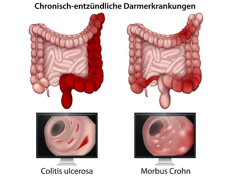 Psychologische Unterstützung