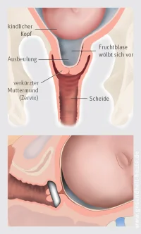 5. Akzeptanz