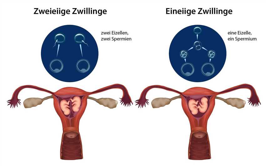 Einflussfaktoren auf die Wahrscheinlichkeit von Zwillingen