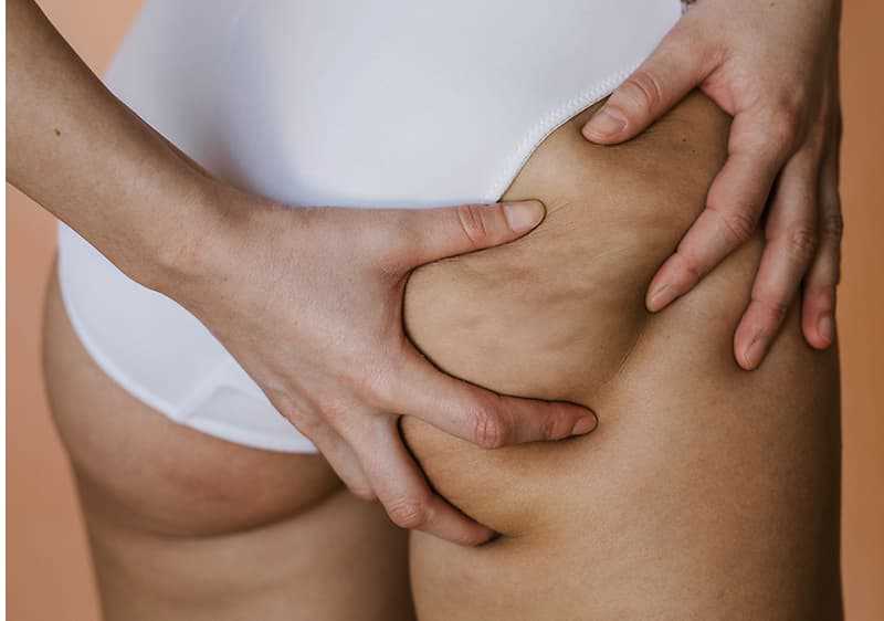 Cellulite am Po loswerden