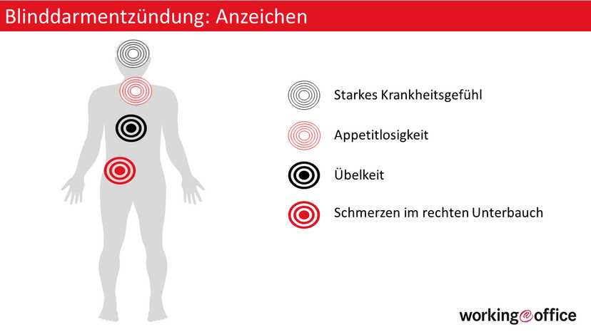 Der Rehabilitationsprozess nach einer OP