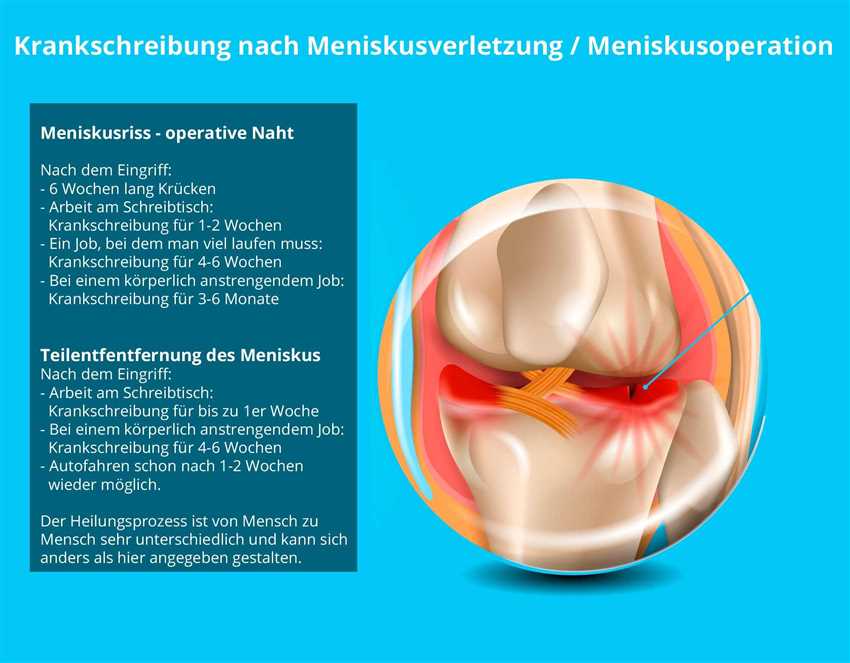 Physiotherapie