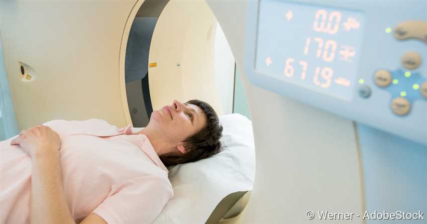 Wie kann man sich auf einen CT-Scan der Lunge vorbereiten?