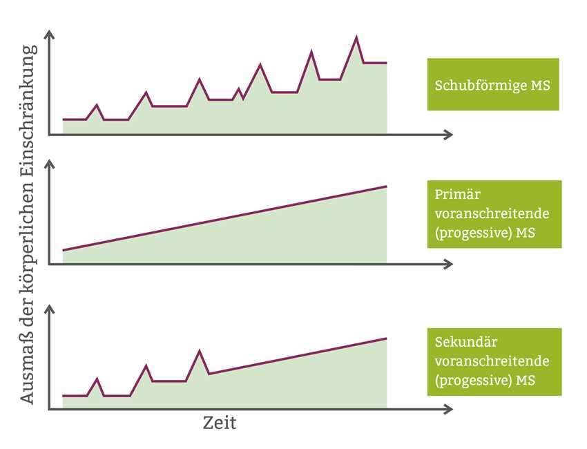 Wie lange dauert ein MS-Schub ohne Cortison?