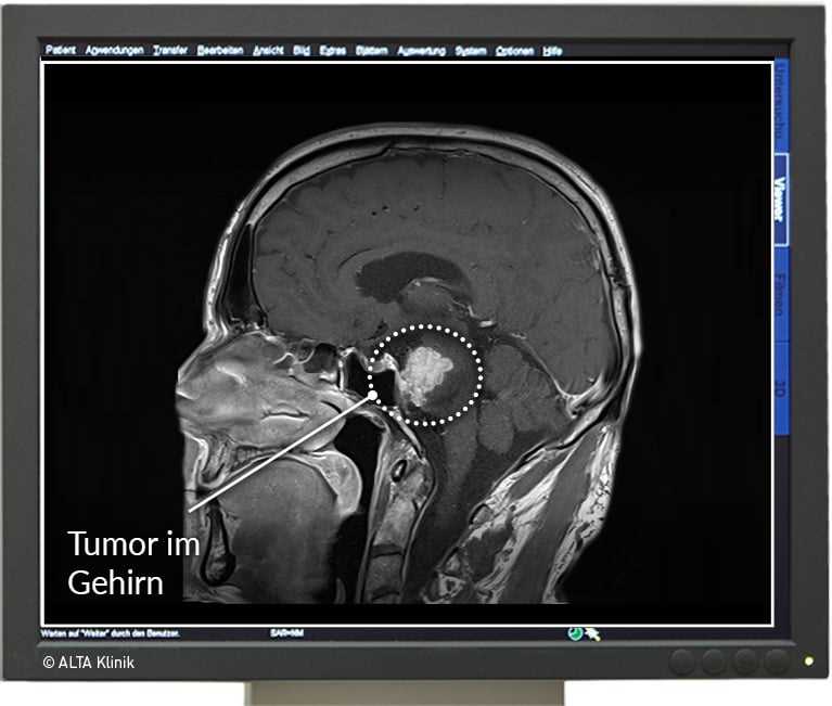 Erfahrung des Radiologen