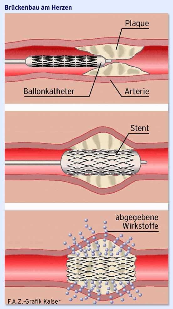 Vorteile