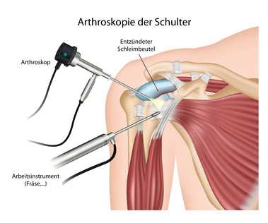 Reha-Programm nach der Operation