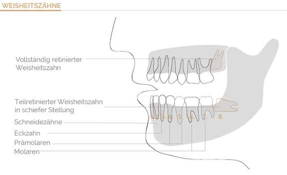 Welche Alternativen gibt es?