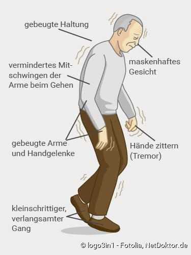 Kleinere Schrift und vermindertes Riechvermögen