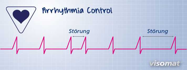 Methode 2: Belastungstest